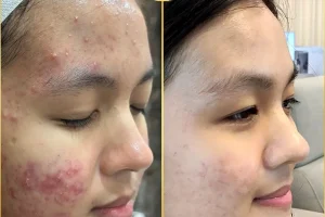 BH Clinic (Anti-Aging, Skin & Hair)
