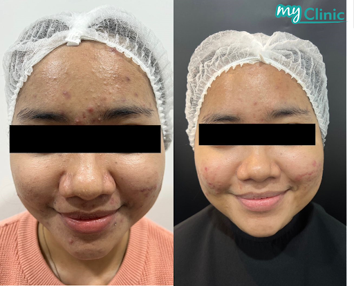MyClinic Aesthetic Skin & Laser Specialist (Sutera Utama, Johor Bahru)