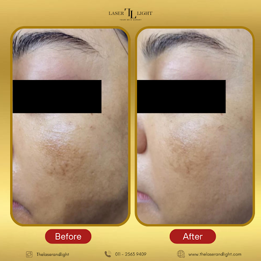 Laser Light Skin Centre (Johor Bahru)