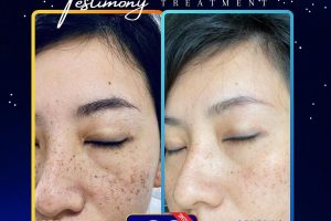 Floles Medispa Seberang Jaya