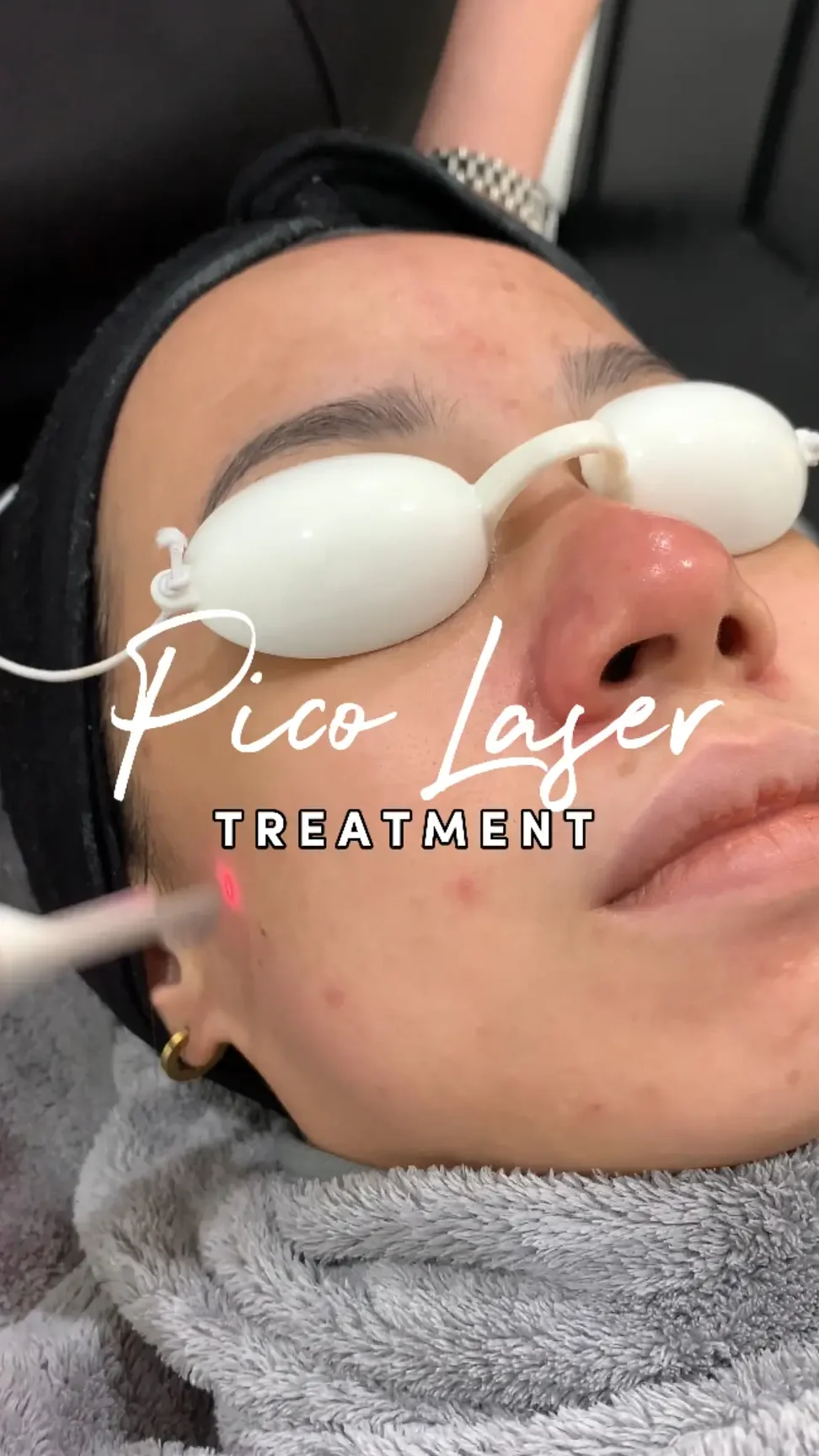 pico laser di selangor malaysia rawatan kulit terbaik manfaat mengejutkan