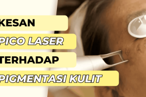 Pico Laser di Sungai Petani, Malaysia: Rawatan Kulit Moden Terbaik untuk Masalah Pigmentasi