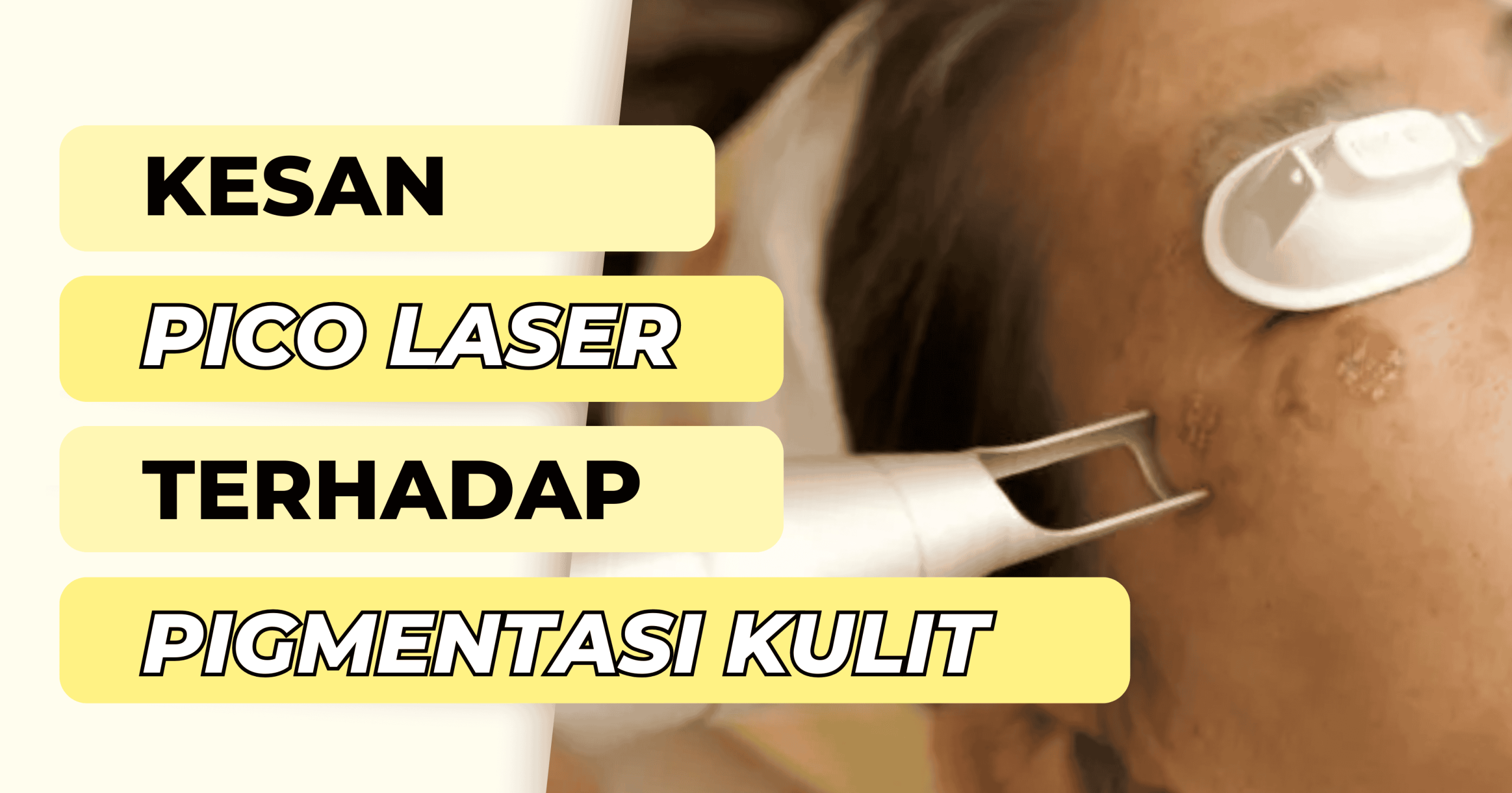 pico laser di sungai petani malaysia rawatan kulit moden terbaik untuk masalah pigmentasi scaled