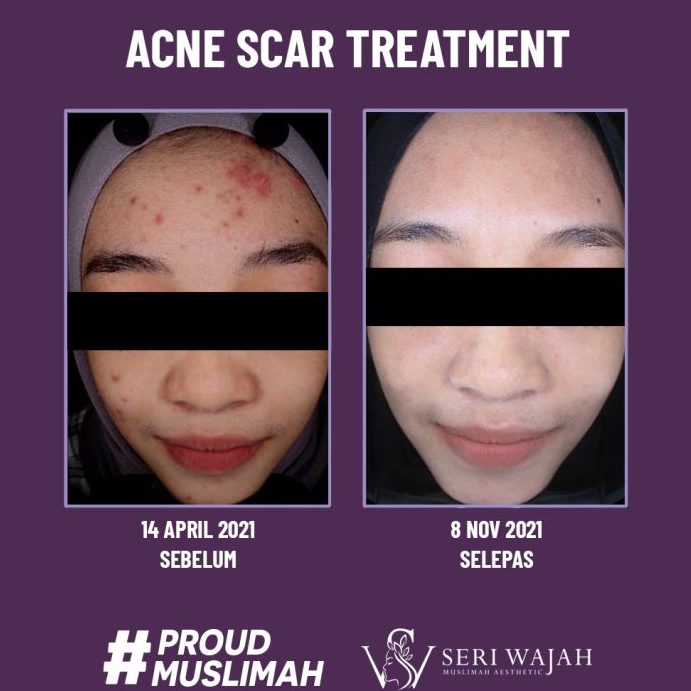 Seri Wajah Muslimah Facial Spa Putrajaya 1 seri wajah muslimah facial spa putrajaya
